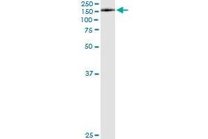 Immunoprecipitation of KIAA1199 transfected lysate using anti-KIAA1199 monoclonal antibody and Protein A Magnetic Bead , and immunoblotted with KIAA1199 MaxPab rabbit polyclonal antibody. (CEMIP 抗体  (AA 880-979))