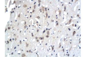 Formalin-fixed and paraffin embedded rat brain tissue labeled with Anti-PKC epsilon Polyclonal Antibody, Unconjugated  followed by conjugation to the secondary antibody