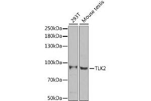 Western blot analysis of extracts of various cell lines, using TLK2 antibody (ABIN2560433) at 1:1000 dilution. (TLK2 抗体)
