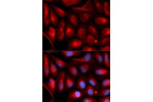 Immunofluorescence analysis of U2OS cells using PSMA5 antibody. (PSMA5 抗体  (AA 1-241))