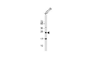 Anti-RAB8A Antibody at 1:1000 dilution + HC whole cell lysate Lysates/proteins at 20 μg per lane. (RAB8A 抗体)