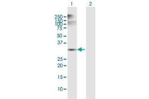 Western Blot analysis of ANXA5 expression in transfected 293T cell line by ANXA5 MaxPab polyclonal antibody. (Annexin V 抗体  (AA 1-320))
