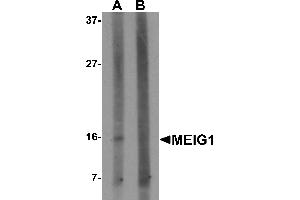 Western blot analysis of MEIG1 in human kidney tissue lysate with MEIG1 antibody at 1 µg/mL in (A) the absence and (B) the presence of blocking peptide. (MEIG1 抗体  (C-Term))