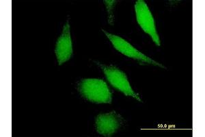 Immunofluorescence of purified MaxPab antibody to DHFR on HeLa cell. (Dihydrofolate Reductase 抗体  (AA 1-187))