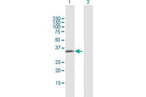 Western Blot analysis of MS4A1 expression in transfected 293T cell line by MS4A1 MaxPab polyclonal antibody. (CD20 抗体  (AA 1-297))
