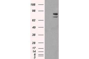 Western Blotting (WB) image for anti-SATB Homeobox 1 (SATB1) antibody (ABIN1500809) (SATB1 抗体)