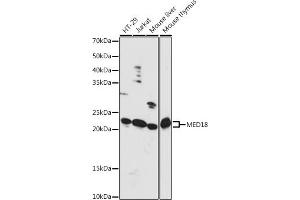 Western blot analysis of extracts of various cell lines, using MED18 antibody (ABIN7268439) at 1:1000 dilution. (MED18 抗体  (AA 30-110))