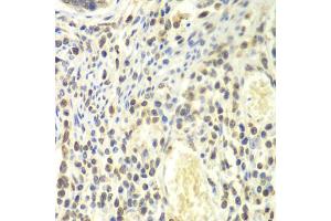 Immunohistochemistry of paraffin-embedded human colon using PSMA4 antibody. (PSMA4 抗体)