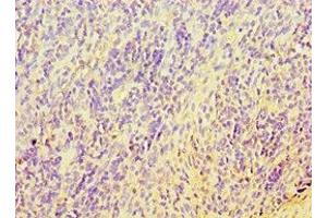 Immunohistochemistry (IHC) image for anti-Telomeric Repeat Binding Factor 2, Interacting Protein (TERF2IP) (AA 1-280) antibody (ABIN7171737)