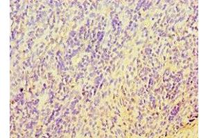 Immunohistochemistry of paraffin-embedded human tonsil tissue using ABIN7171737 at dilution of 1:100 (RAP1 抗体  (AA 1-280))