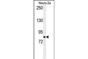 Western blot analysis of CQ028 Antibody in Neuro-2a cell line lysates (35ug/lane) (HID1/DMC1 抗体  (C-Term))