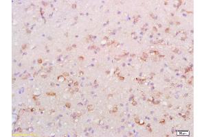 Formalin-fixed and paraffin embedded rat brain labeled with Anti-ATG1/ULK1 Polyclonal Antibody, Unconjugated (ABIN701440) at 1:200 followed by conjugation to the secondary antibody and DAB staining. (ULK1 抗体  (AA 951-1050))