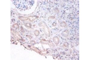 Immunohistochemistry of paraffin-embedded human kidney tissue using ABIN7149438 at dilution of 1:100 (PHGDH 抗体  (AA 2-251))