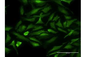Immunofluorescence of monoclonal antibody to CDK9 on HeLa cell. (CDK9 抗体  (AA 271-372))
