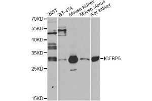 Western blot analysis of extracts of various cell lines, using IGFBP5 antibody (ABIN6292146) at 1:1000 dilution. (IGFBP5 抗体)