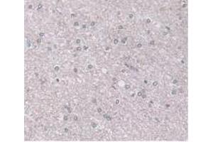 IHC-P analysis of Human Brain Tissue, with DAB staining. (ORM1 抗体  (AA 19-201))