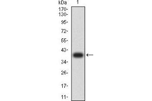 Western blot analysis using COL3A1 mAb against human COL3A1 (AA: 24-153) recombinant protein. (COL3A1 抗体  (AA 24-153))