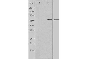 Western blot analysis of extracts from COLO cells, using CNKR1 antibody. (CNKSR1 抗体  (Internal Region))