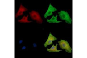 ABIN7097093 and ABIN7101160 staining  cells by IF/ICC. (PTAR1 抗体)