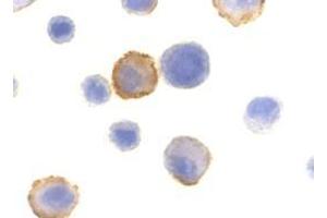 Immunocytochemistry of Bmf in HeLa cells with AP30157PU-N Bmf antibody at 10 μg/ml. (BMF 抗体  (N-Term))