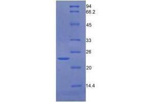 Image no. 1 for Growth Arrest-Specific 6 (GAS6) (AA 136-311) (Active) protein (His tag) (ABIN6239765)