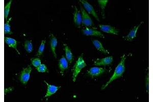Immunofluorescent analysis of Hela cells using ABIN7156142 at dilution of 1:100 and Alexa Fluor 488-congugated AffiniPure Goat Anti-Rabbit IgG(H+L) (IPO13 抗体  (AA 501-700))