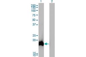 Western Blot analysis of AHNAK expression in transfected 293T cell line by AHNAK monoclonal antibody (M01), clone 3G7. (AHNAK 抗体  (AA 1-100))