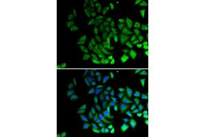 Immunofluorescence (IF) image for anti-Piwi-Like 1 (PIWIL1) antibody (ABIN6219364) (PIWIL1 抗体)