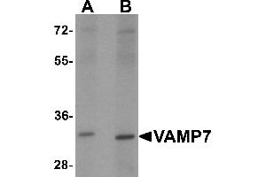 Western blot analysis of VAMP7 in mouse lung tissue lysate with VAMP7 antibody at 1 µg/mL. (VAMP7 抗体)