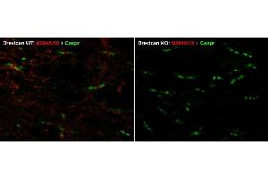 Immunoblot against adult rat brain membrane (RBM) or low- speed pellet (RBLSP) fractions denatured at 95oC for 5 min or 37oC for 15 min and probed with N253/32 (left) and K58/35 (right) TC supe.