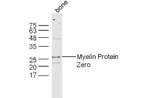 Bone lysates probed with Myelin Protein Zero Polyclonal Antibody, Unconjugated  at 1:300 dilution and 4˚C overnight incubation. (MPZ 抗体  (AA 175-248))