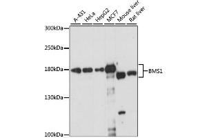 Western blot analysis of extracts of various cell lines, using BMS1 antibody (ABIN6292658) at 1:1000 dilution. (BMS1 抗体)