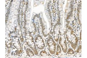 ABIN6256314 and ABIN6267147 at 1/100 staining Rat colorectal tissue by IHC-P.