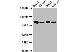 Western Blot Positive WB detected in: Rat heart tissue, Rat kidney tissue, Mouse heart tisseu, Mouse kidney tissue All lanes: ITGA6 antibody at 3 μg/mL Secondary Goat polyclonal to rabbit IgG at 1/50000 dilution Predicted band size: 127, 120, 123, 122, 125, 107 kDa Observed band size: 100 kDa (ITGA6 抗体  (AA 625-866))