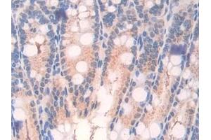 Detection of ATF7 in Mouse Intestine Tissue using Polyclonal Antibody to Activating Transcription Factor 7 (ATF7) (ATF7 抗体  (AA 50-270))
