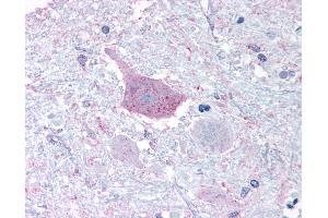 Anti-MRGPRD antibody IHC of human brain, medulla. (MRGPRD 抗体  (Cytoplasmic Domain))