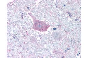 Anti-MRGPRD antibody IHC of human brain, medulla. (MRGPRD 抗体  (Cytoplasmic Domain))