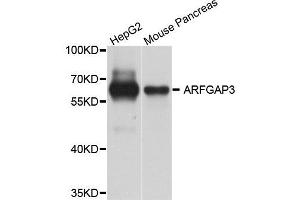 Western blot analysis of extract of HepG2 and mouse pancreas cells, using ARFGAP3 antibody. (ARFGAP3 抗体)