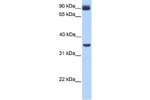 Western Blotting (WB) image for anti-Potassium Inwardly-Rectifying Channel, Subfamily J, Member 5 (KCNJ5) antibody (ABIN2458042) (KCNJ5 抗体)