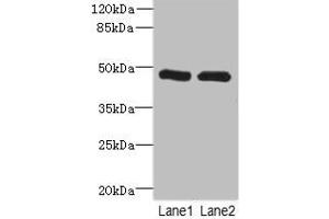Western blot All lanes: HGDantibody at 2. (HGD 抗体  (AA 226-445))