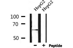 Western blot analysis of extracts from HepG2, using GPR153 Antibody. (GPR153 抗体  (Internal Region))