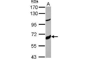 Western Blotting (WB) image for anti-Cytochrome P450, Family 17, Subfamily A, Polypeptide 1 (CYP17A1) (Center) antibody (ABIN2855475)
