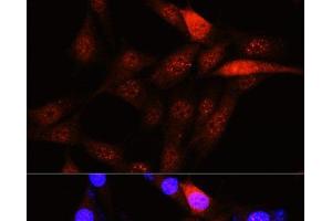 Immunofluorescence analysis of NIH-3T3 cells using PLK1 Polyclonal Antibody at dilution of 1:100 (40x lens). (PLK1 抗体)