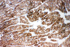 Immunohistochemistry (IHC) image for anti-NADH Dehydrogenase (Ubiquinone) 1 alpha Subcomplex, 1, 7.5kDa (NDUFA1) (AA 54-70), (C-Term) antibody (ABIN3044247)