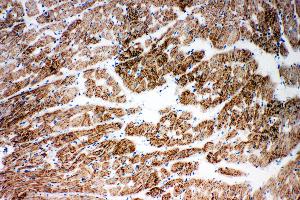 Anti-NDUFA1 antibody, IHC(F) IHC(F): Rat Cardiac Muscle Tissue (NDUFA1 抗体  (C-Term))