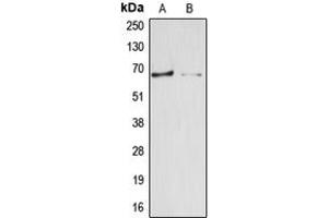 Western blot analysis of Arylsulfatase E expression in HepG2 (A), HEK293T (B) whole cell lysates. (Arylsulfatase E 抗体  (Center))
