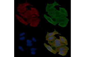ABIN6262729 and ABIN6278925 staining Hela cells(30 min of UV treatment) by IF/ICC. (Keratin 6 抗体  (C-Term))