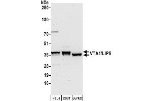 Western Blotting (WB) image for anti-Vps20-Associated 1 Homolog (VTA1) (AA 250-300) antibody (ABIN7450903)
