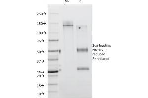 SDS-PAGE Analysis Purified CD45RA Mouse Monoclonal Antibody (111-1C5).