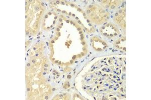 Immunohistochemistry of paraffin-embedded human kidney using ZNF346 antibody (ABIN5971759) at dilution of 1/100 (40x lens). (ZNF346 抗体)
